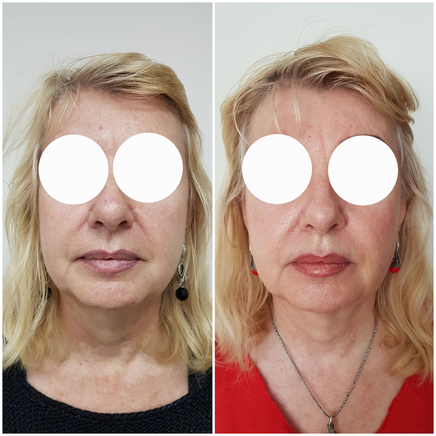 WhatsApp Image 2026-01-07 at 16.07.54 (1)