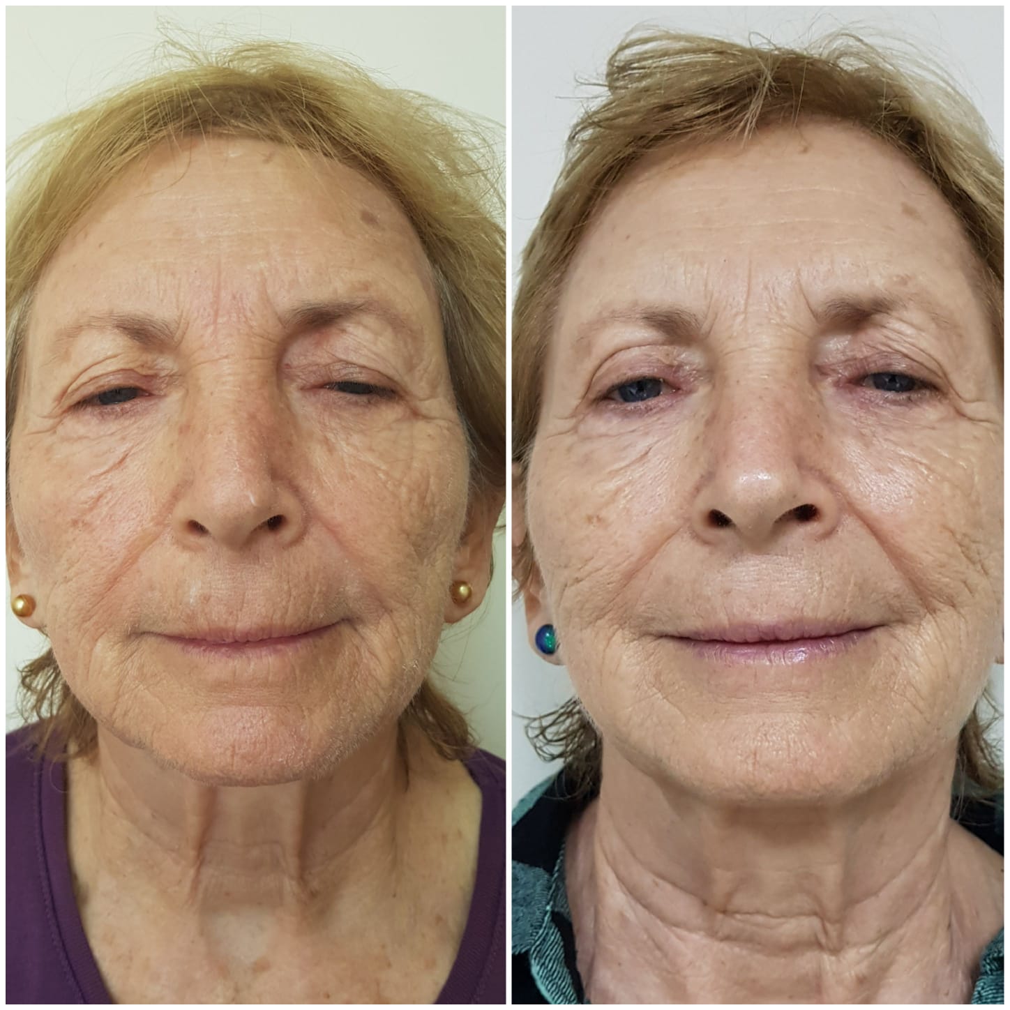 WhatsApp Image 2026-01-07 at 16.07.54 (2)