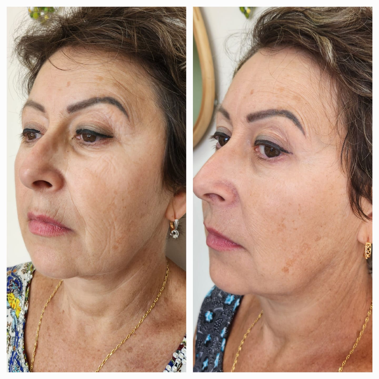 WhatsApp Image 2026-01-07 at 16.10.31 (1)